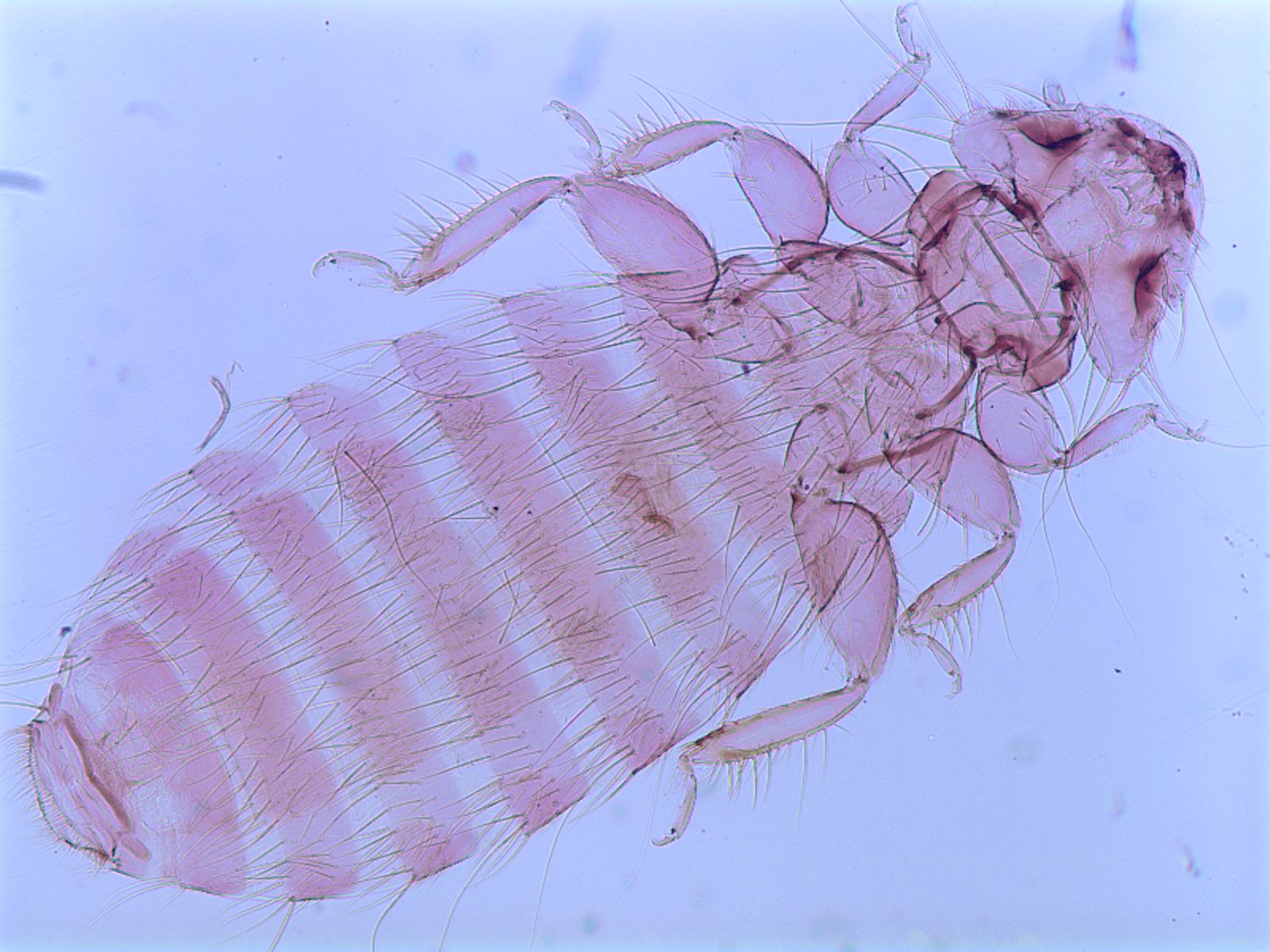 Пухоеды это. Пухоеды (Mallophaga). Отряд пухоеды и власоеды. Пухоед Menacanthus stramineus. Menopon gallinae.