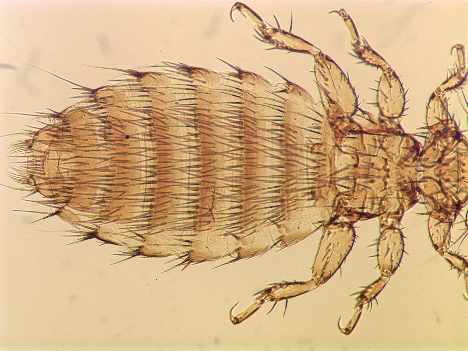 Пухоеды это. Отряд пухоеды и вши. Пухоеды и вши паразитические насекомые. Жук пухоед. Menopon gallinae.