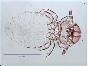 Bovicola limbatus